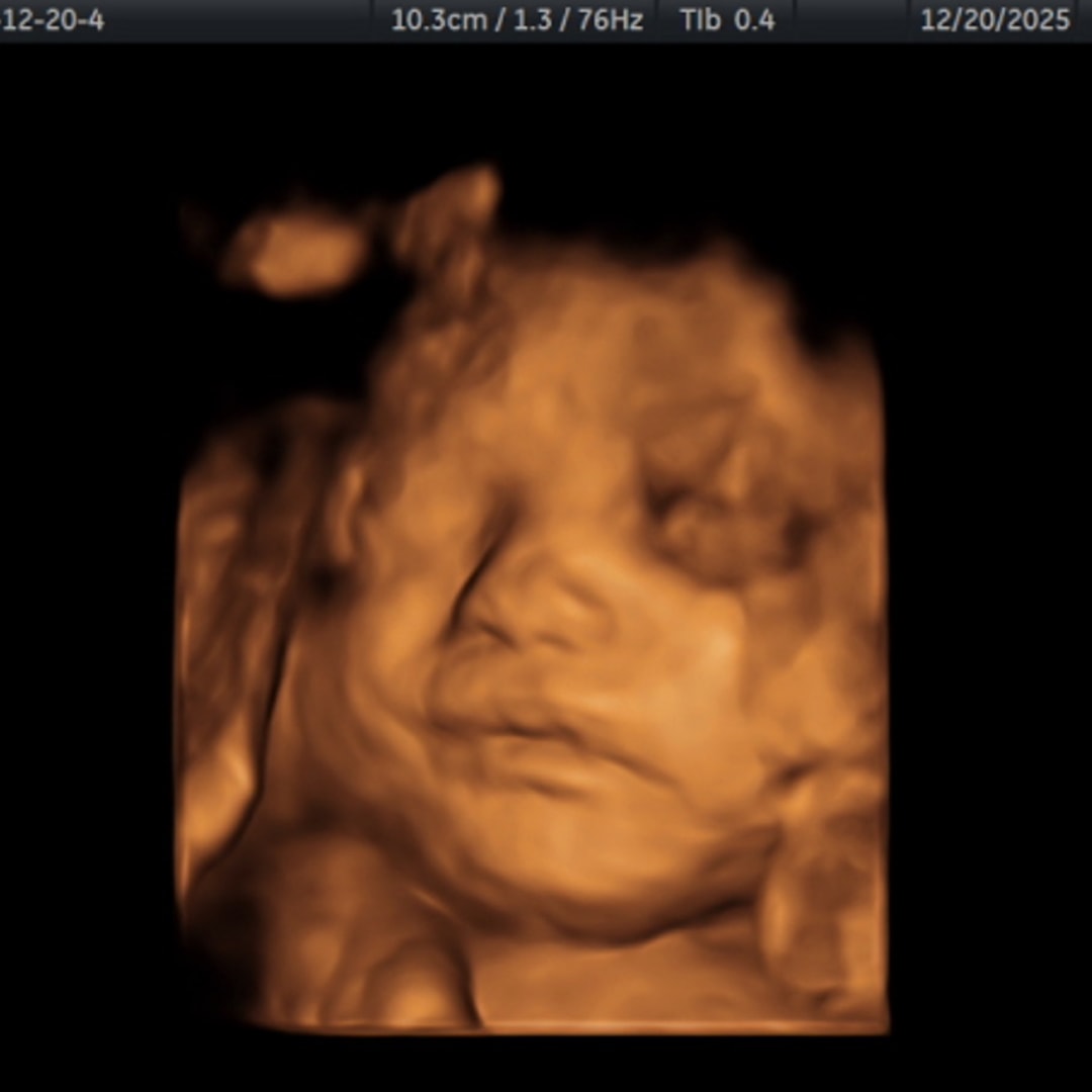 Photo shared by Evelyn for their Babylist baby registry.