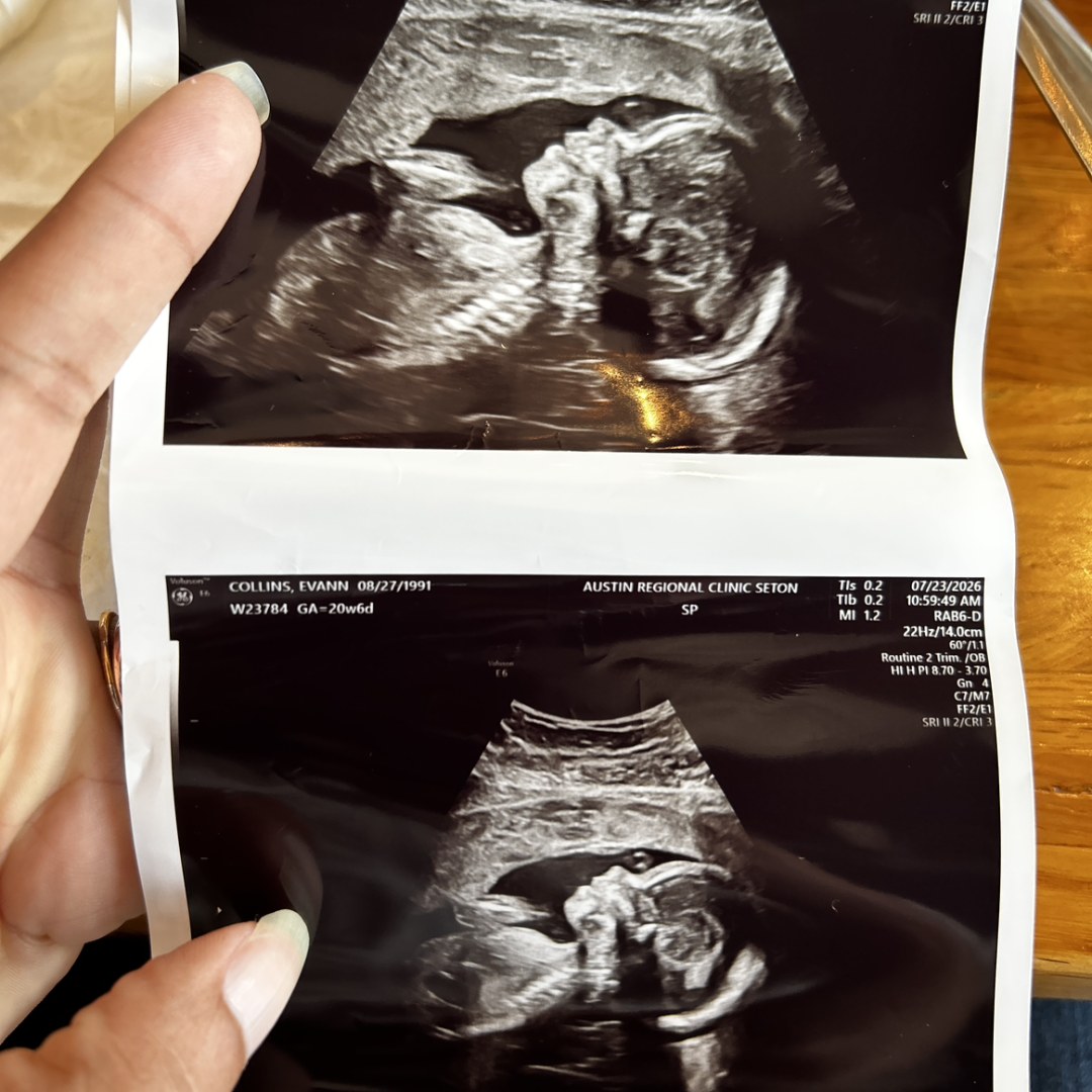 Photo shared by Evann for their Babylist baby registry.