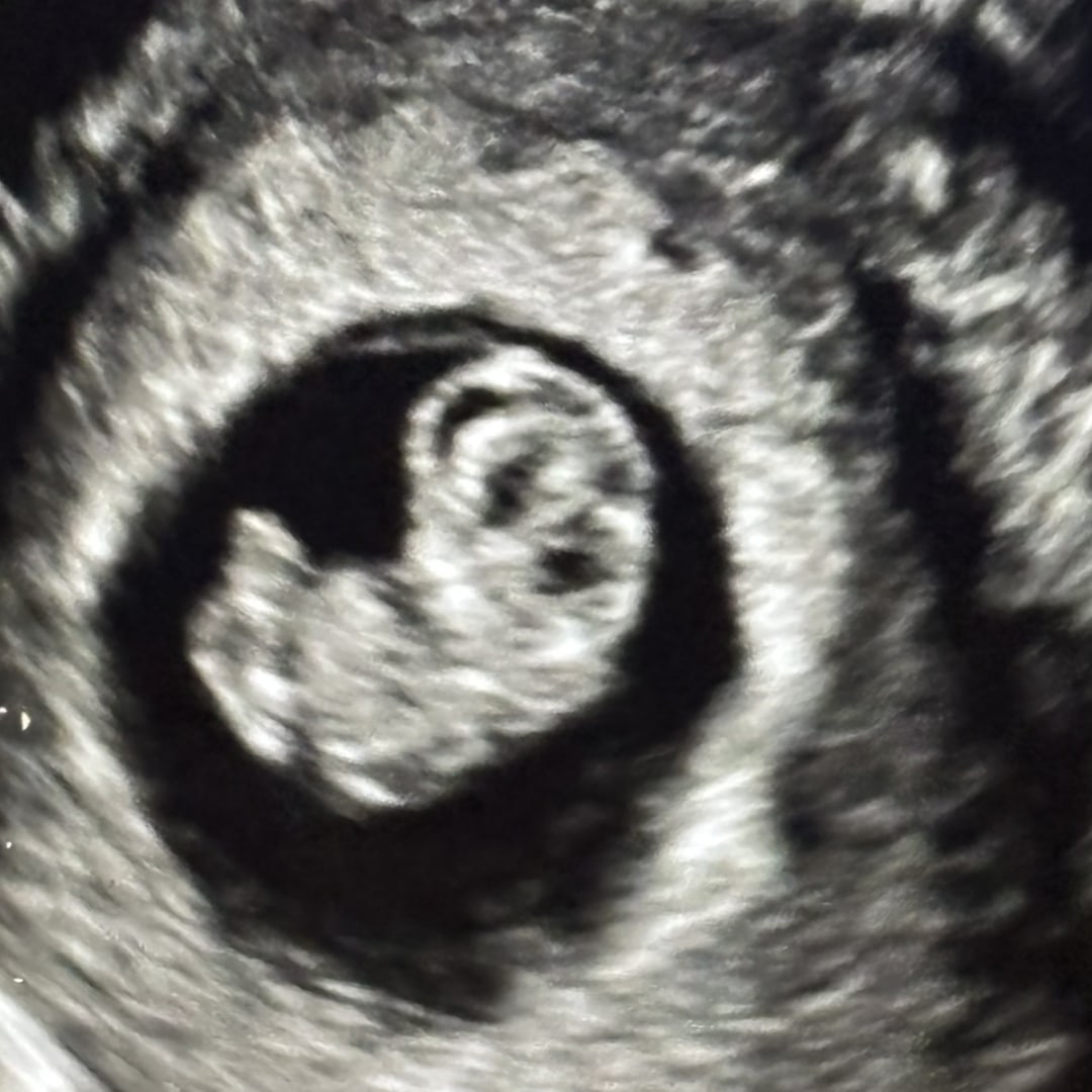 Photo shared by Ashlyn for their Babylist baby registry.