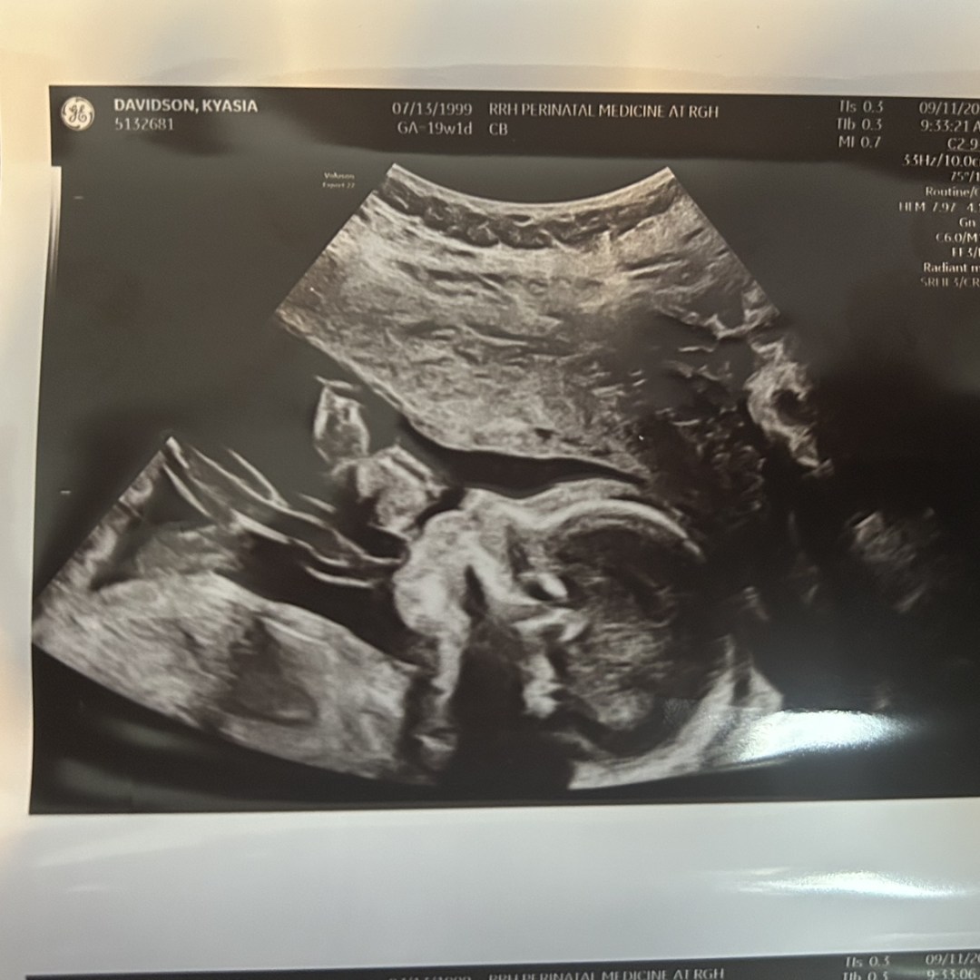 Photo shared by Kyasia for their Babylist baby registry.