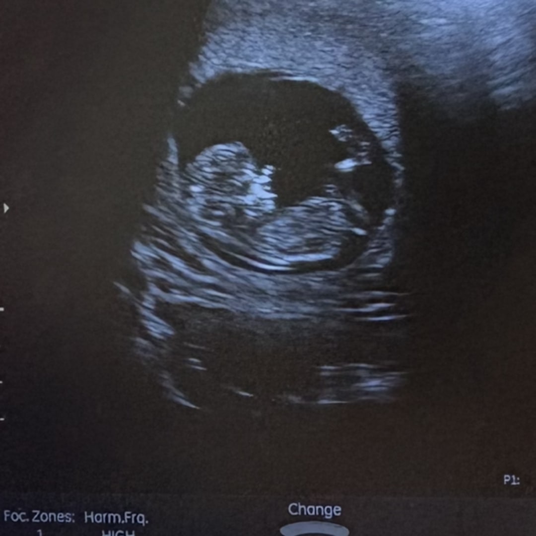 Photo shared by Mollie for their Babylist baby registry.