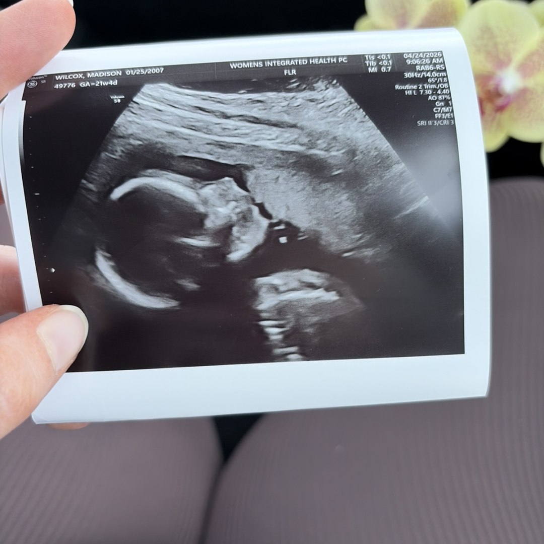 Photo shared by Madison for their Babylist baby registry.