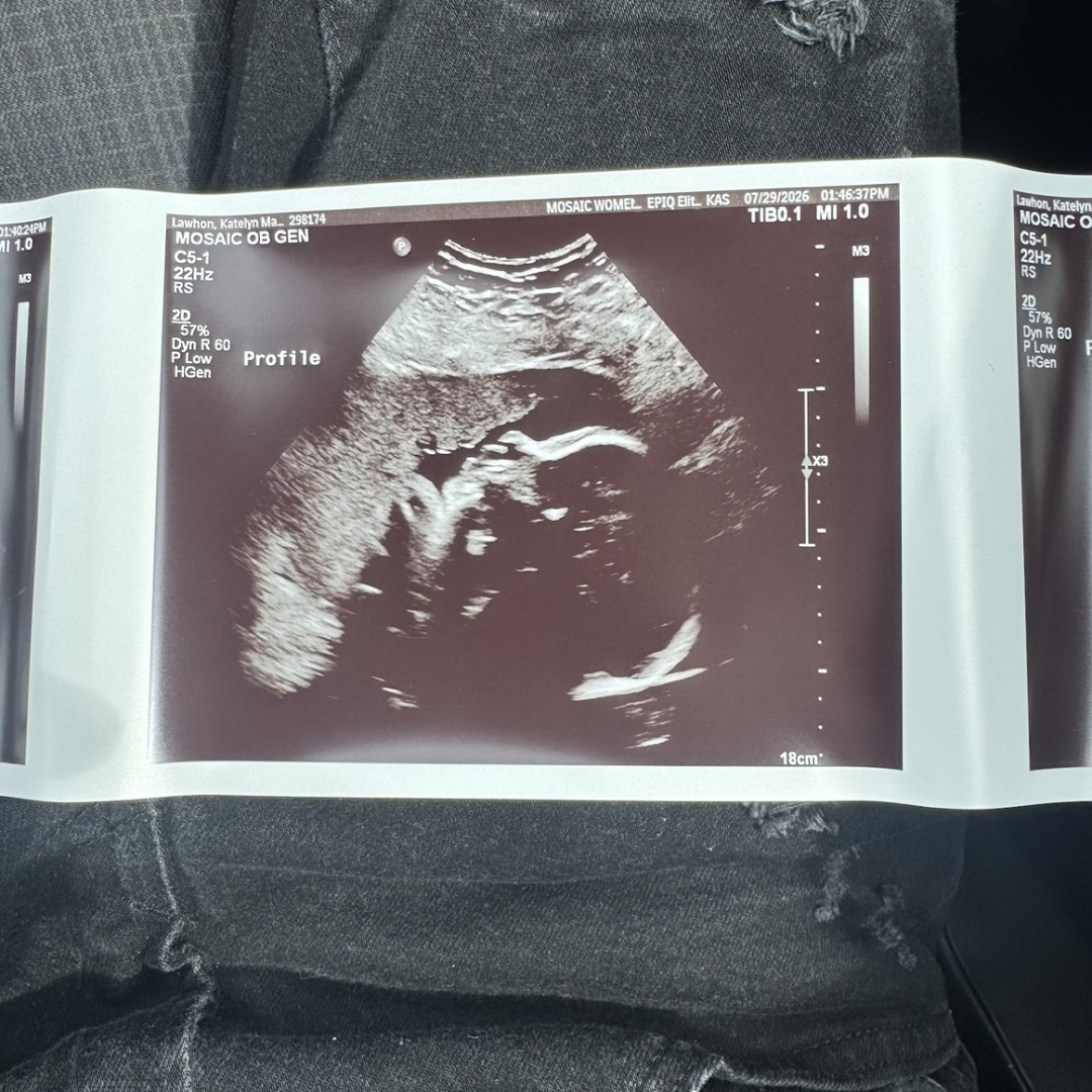 Photo shared by Katelyn for their Babylist baby registry.