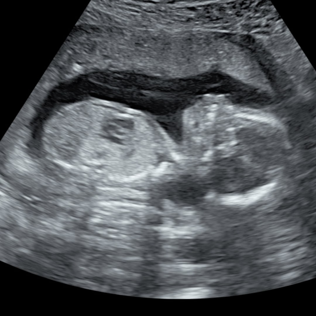 Photo shared by Brittney for their Babylist baby registry.