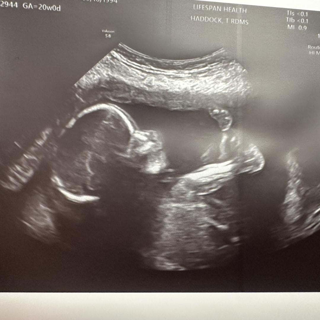 Photo shared by Samantha for their Babylist baby registry.