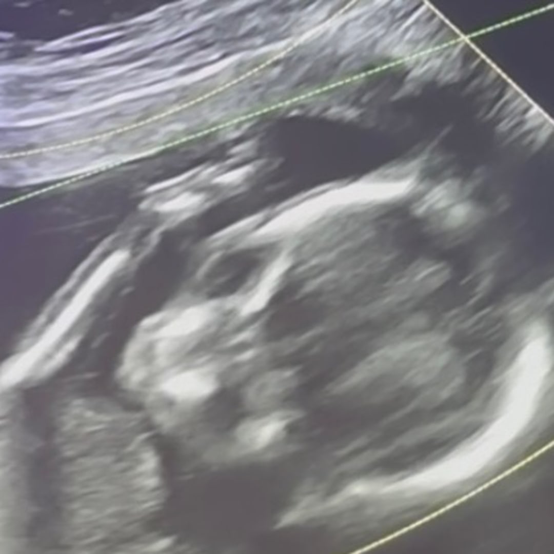 Photo shared by Raylen for their Babylist baby registry.