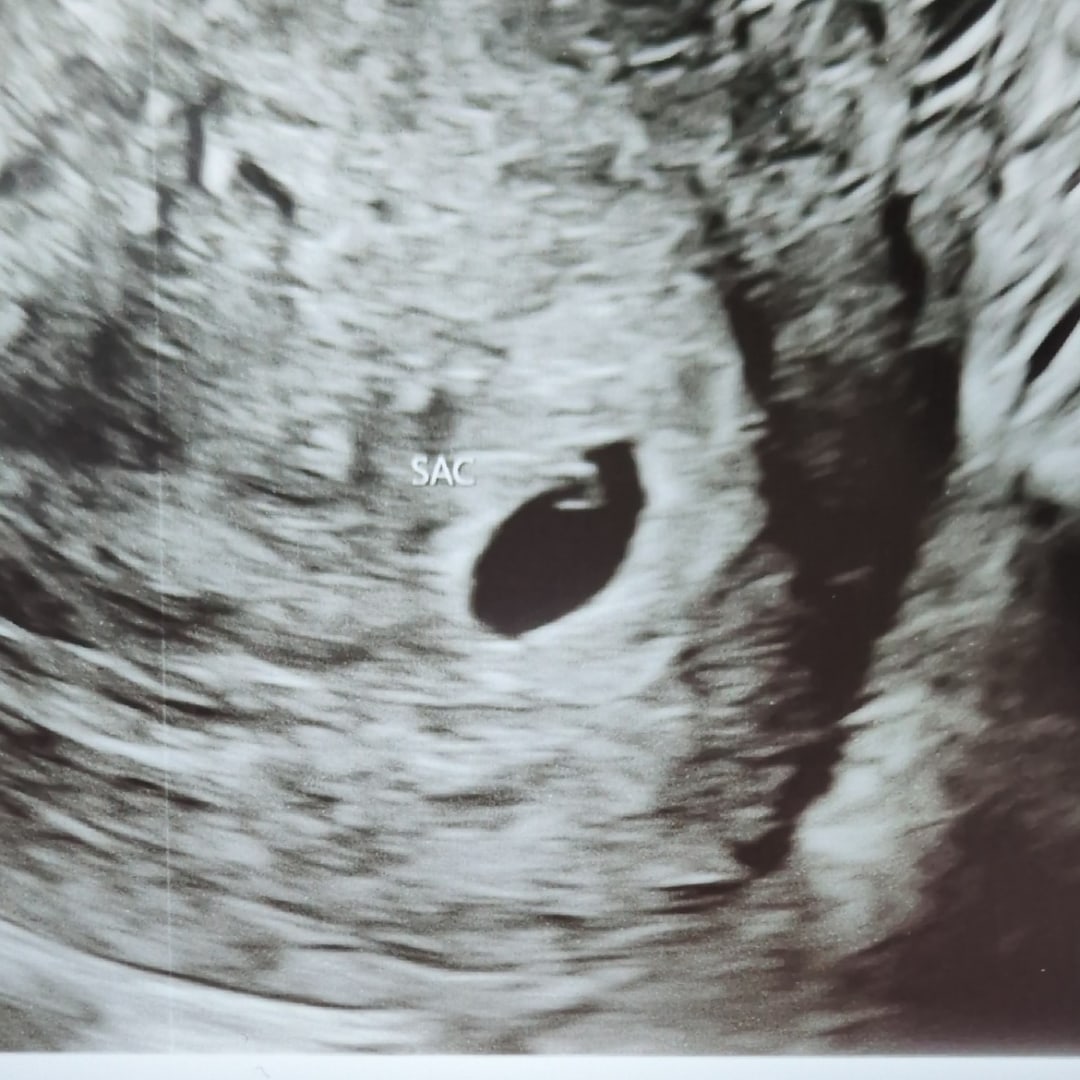 Photo shared by Kat for their Babylist baby registry.