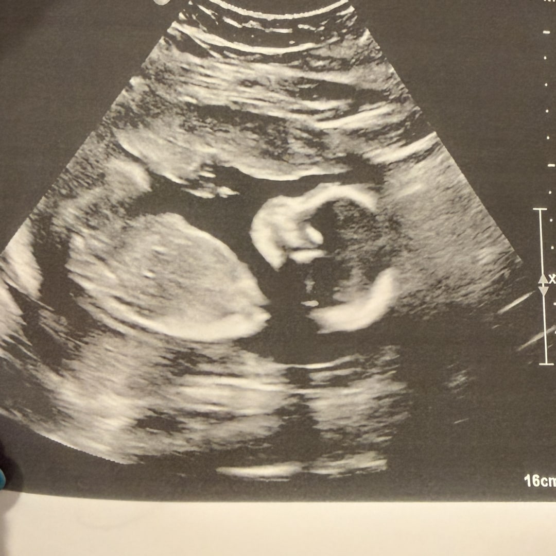 Photo shared by Karina for their Babylist baby registry.