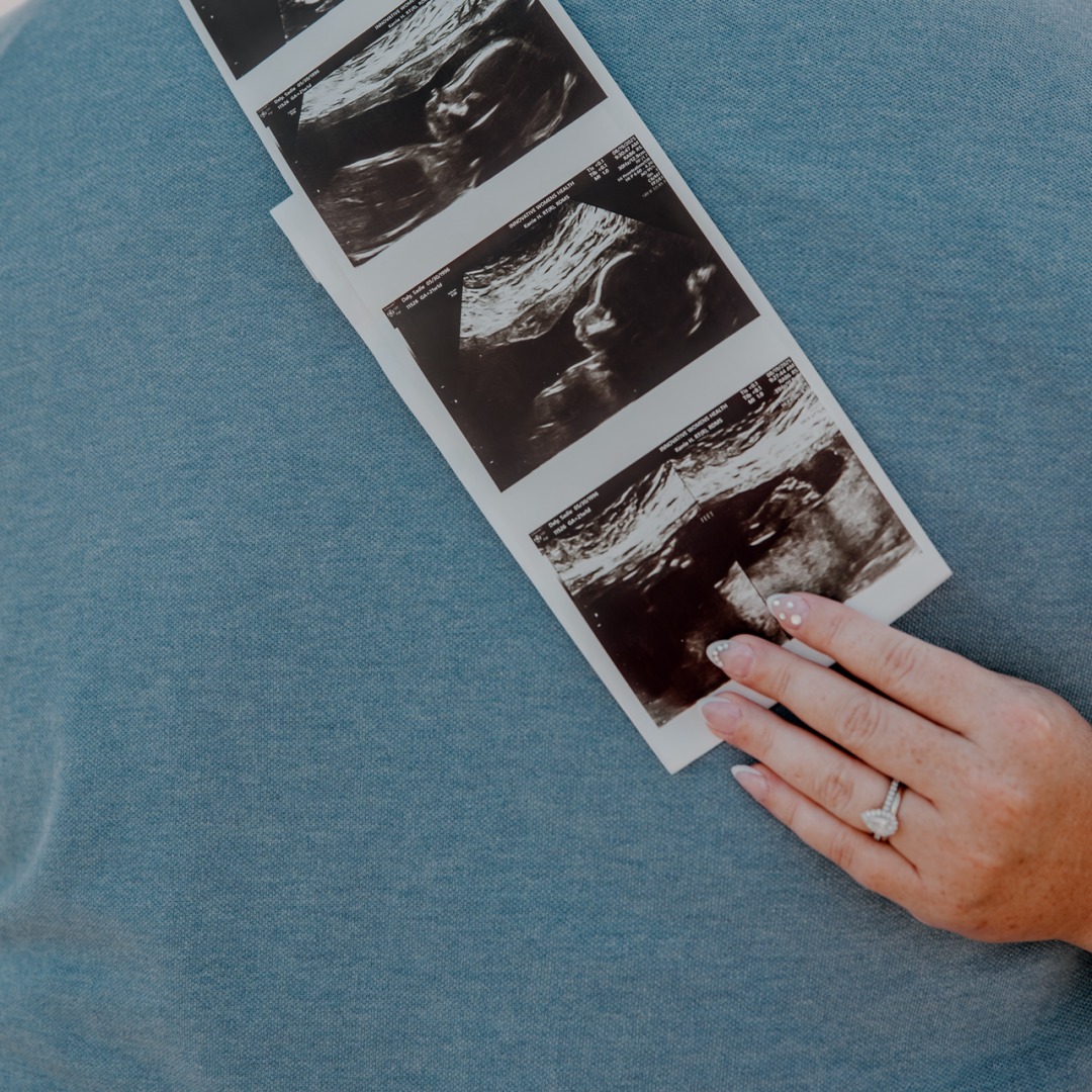 Photo shared by Sadie for their Babylist baby registry.