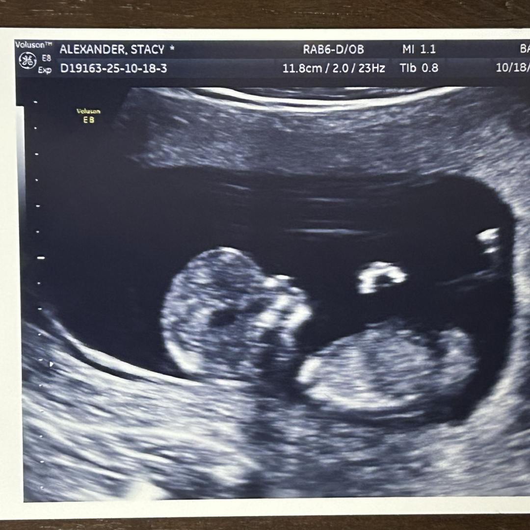 Photo shared by Stacy for their Babylist baby registry.