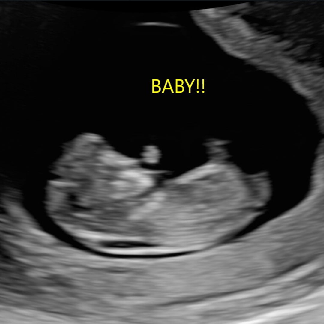 Photo shared by Jaiden for their Babylist baby registry.