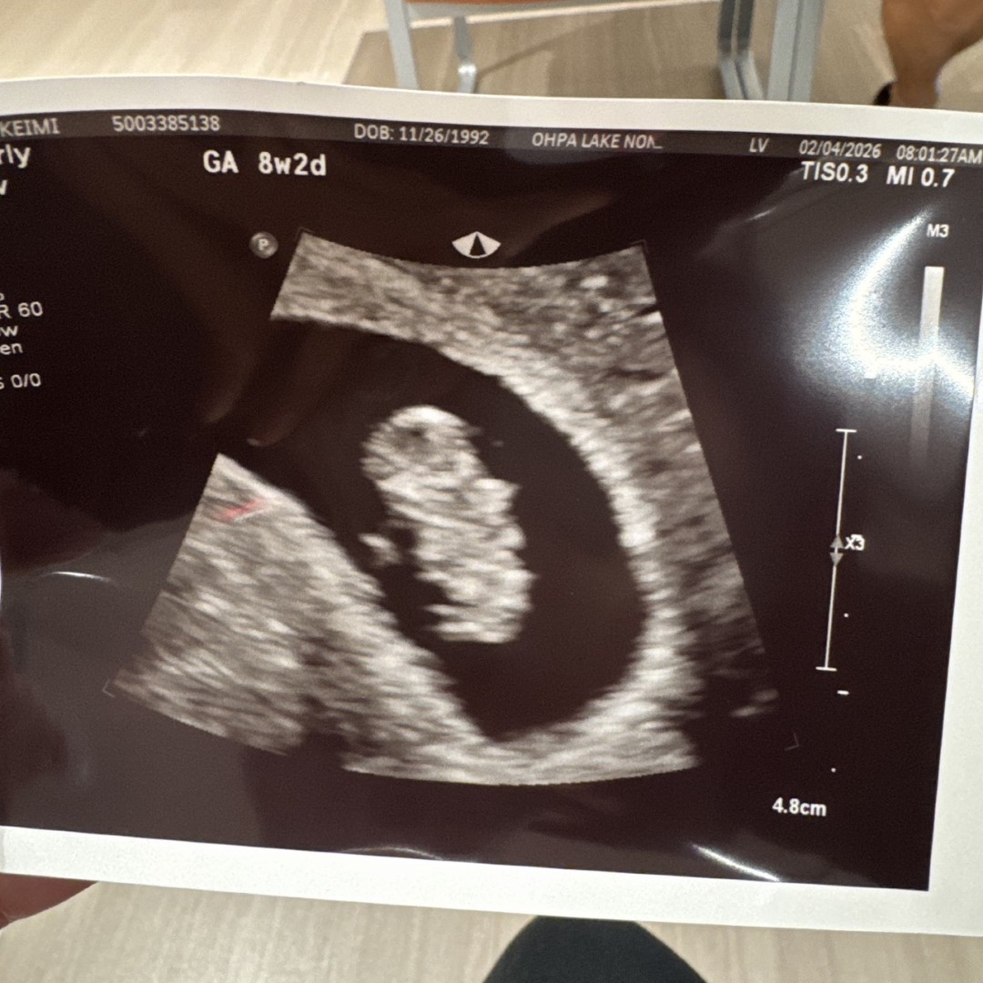 Photo shared by Jalena for their Babylist baby registry.