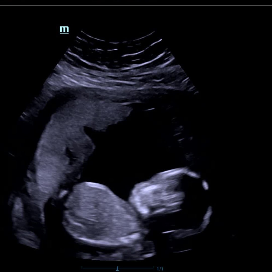 Photo shared by Delisha for their Babylist baby registry.