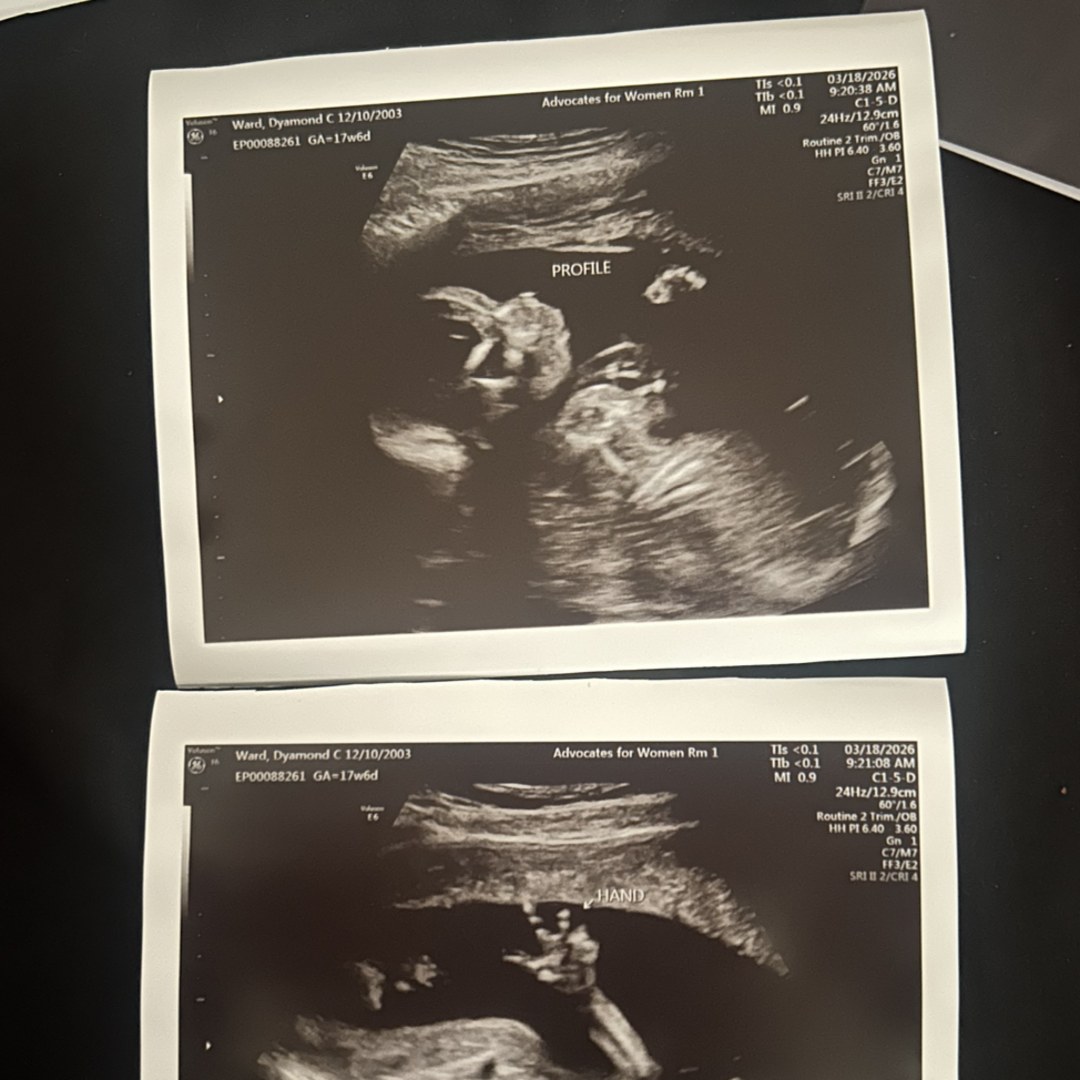 Photo shared by Dyamond for their Babylist baby registry.