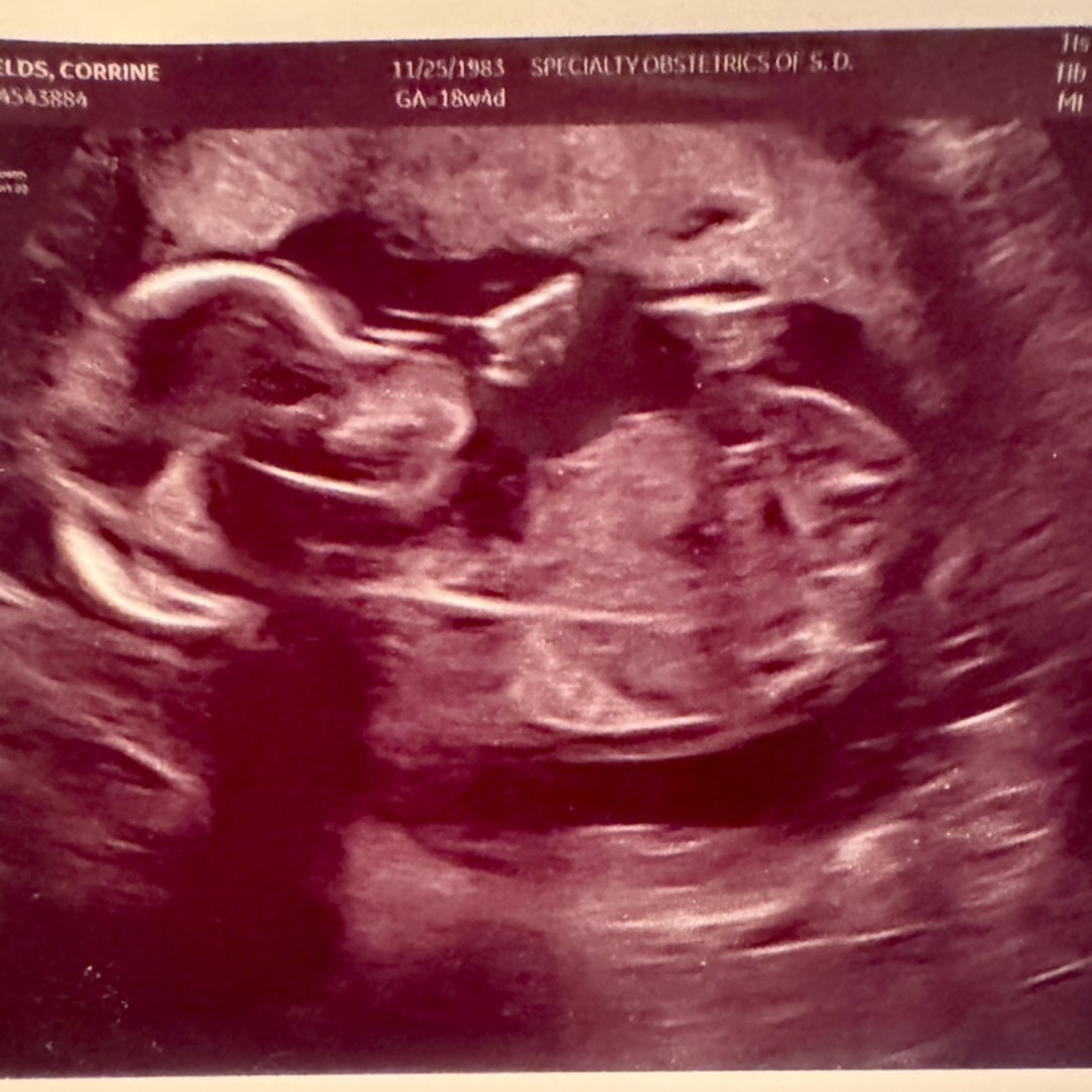 Photo shared by Corrine for their Babylist baby registry.