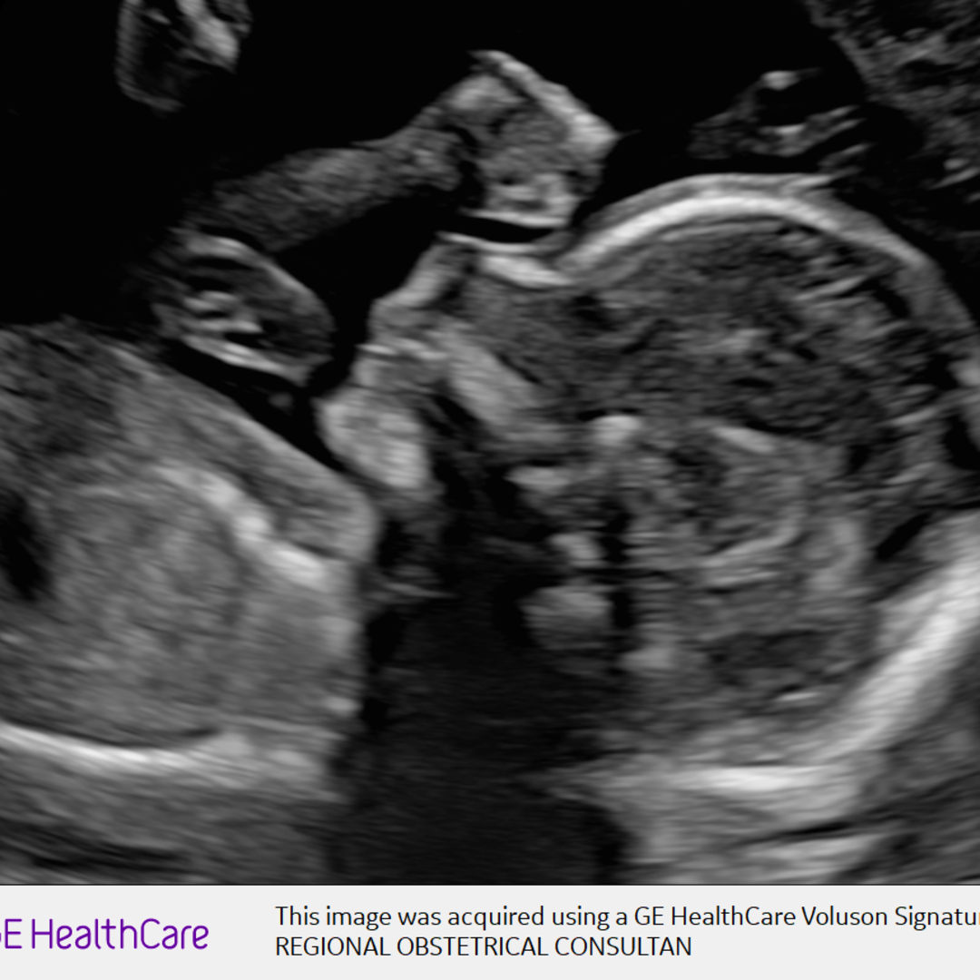 Photo shared by Makensie for their Babylist baby registry.