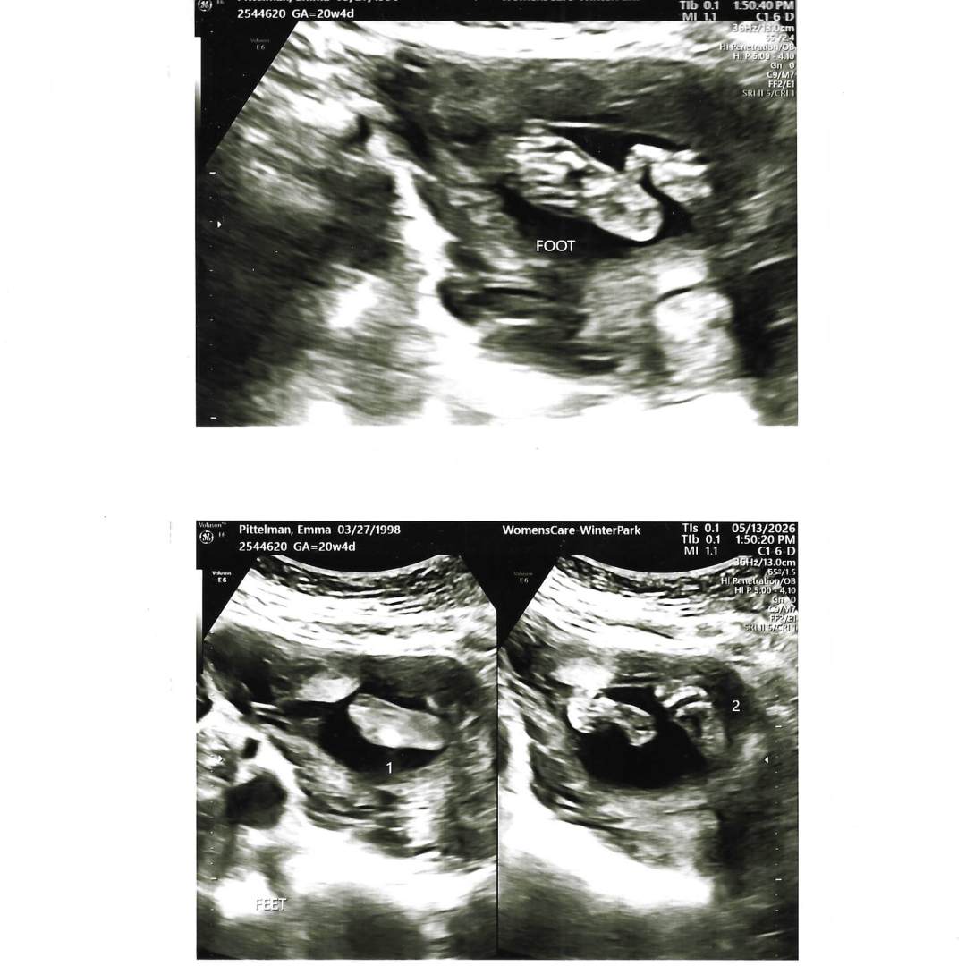 Photo shared by Emma for their Babylist baby registry.