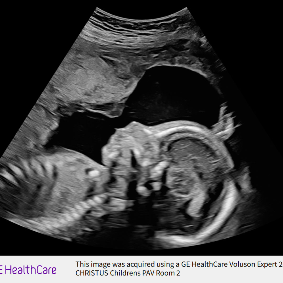 Photo shared by Cayla for their Babylist baby registry.