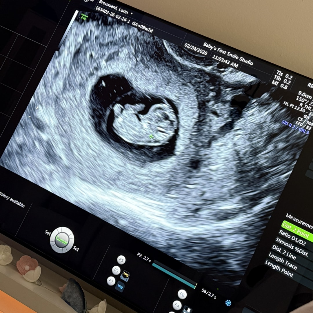 Photo shared by Lorin for their Babylist baby registry.