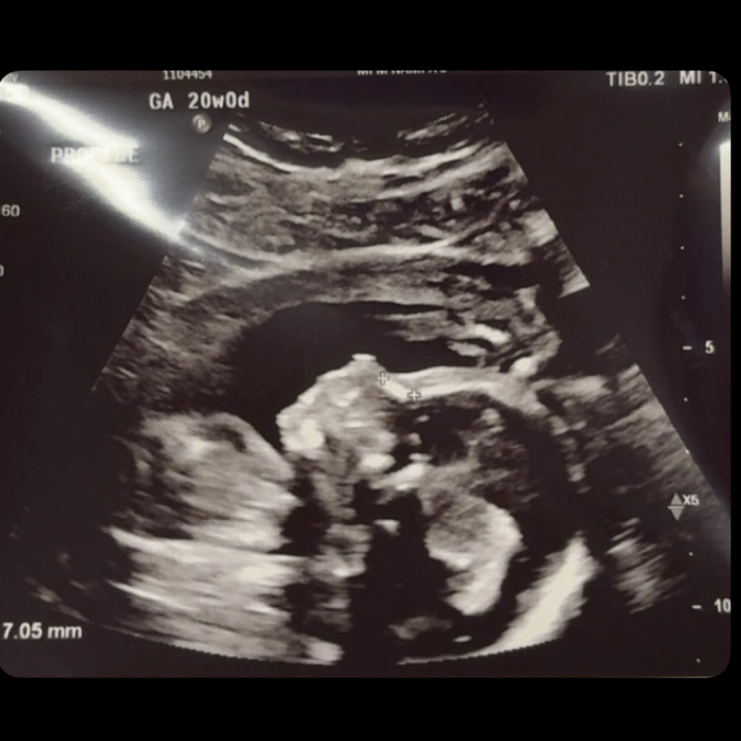 Photo shared by Reilly for their Babylist baby registry.