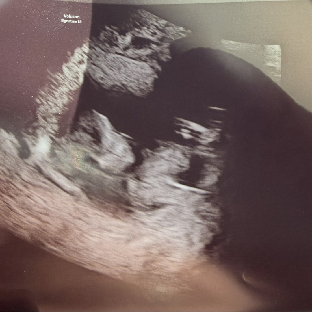 Photo shared by Kiah for their Babylist baby registry.