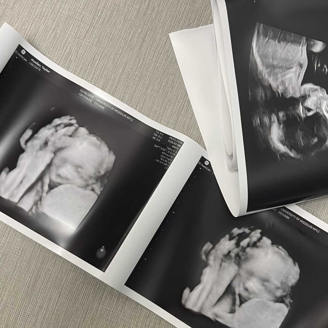 Photo shared by Taylor for their Babylist baby registry.
