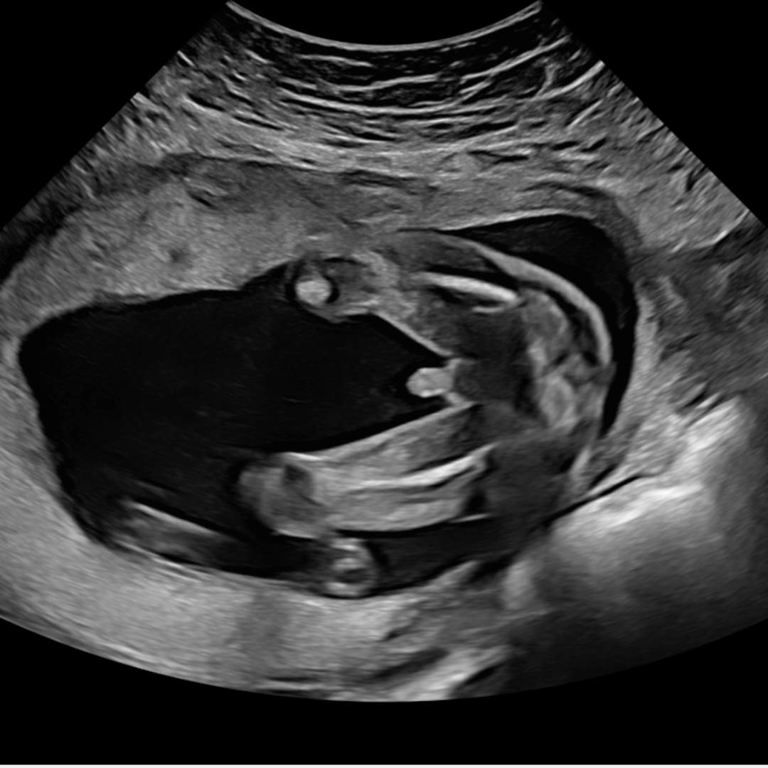 Photo shared by Abi for their Babylist baby registry.