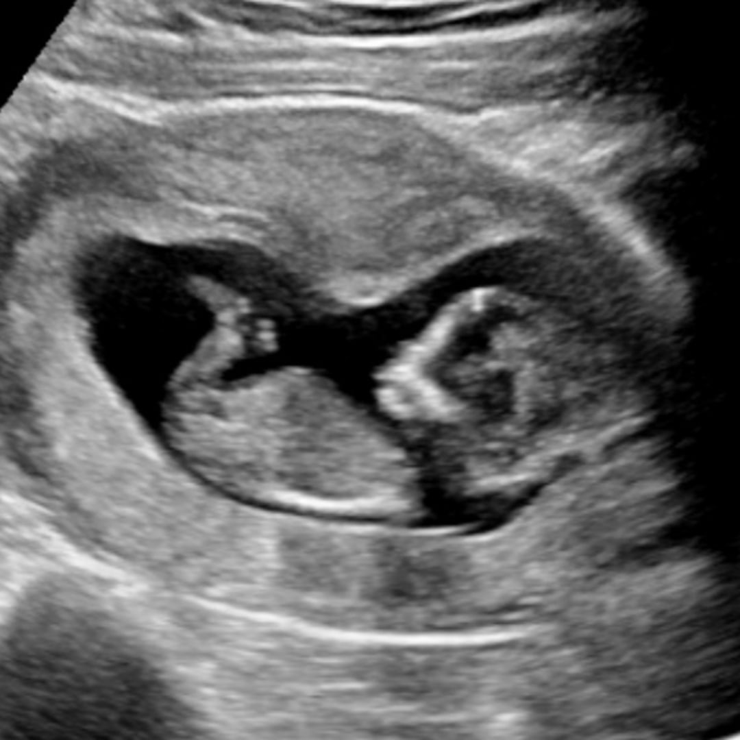 Photo shared by Zoe for their Babylist baby registry.