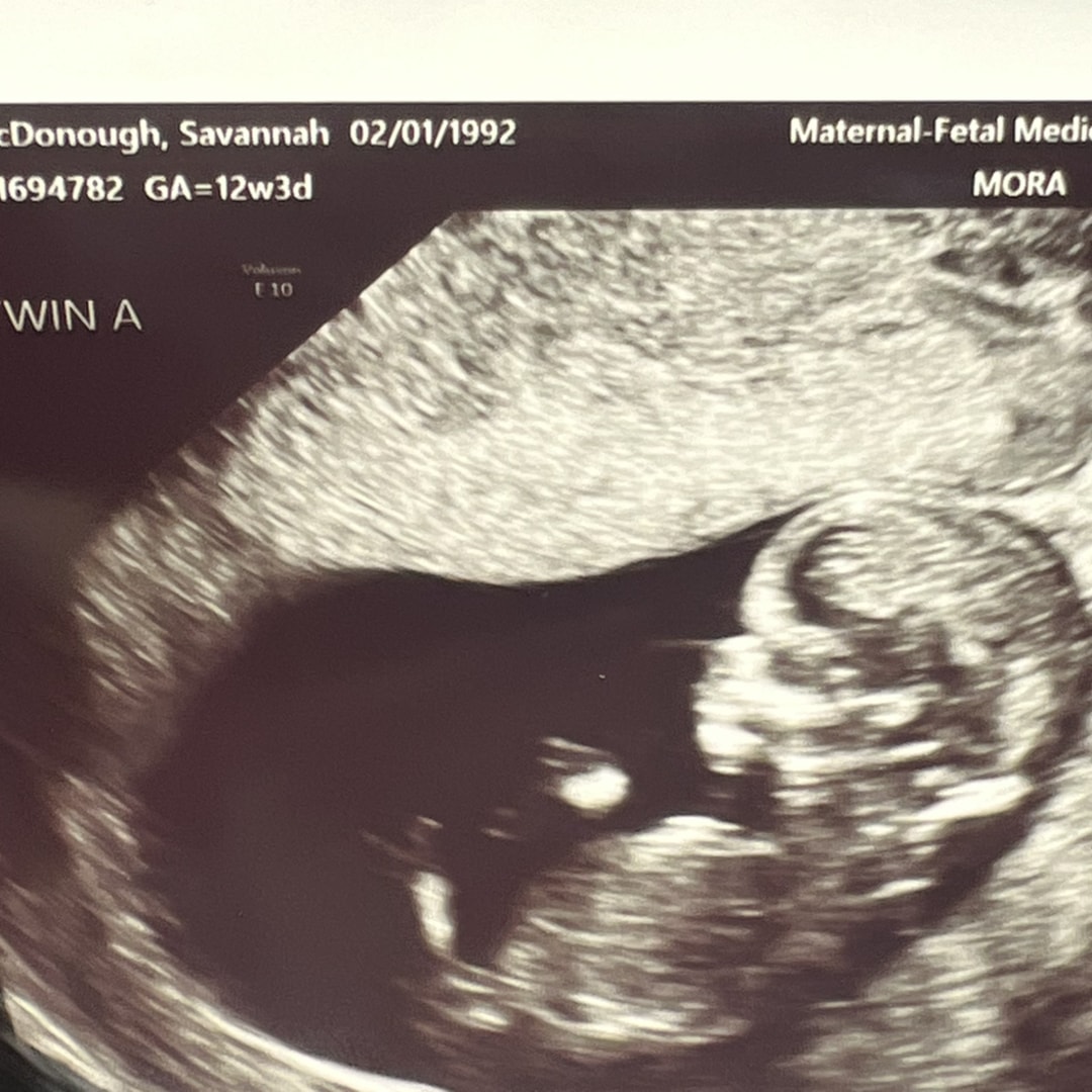 Photo shared by Savannah for their Babylist baby registry.