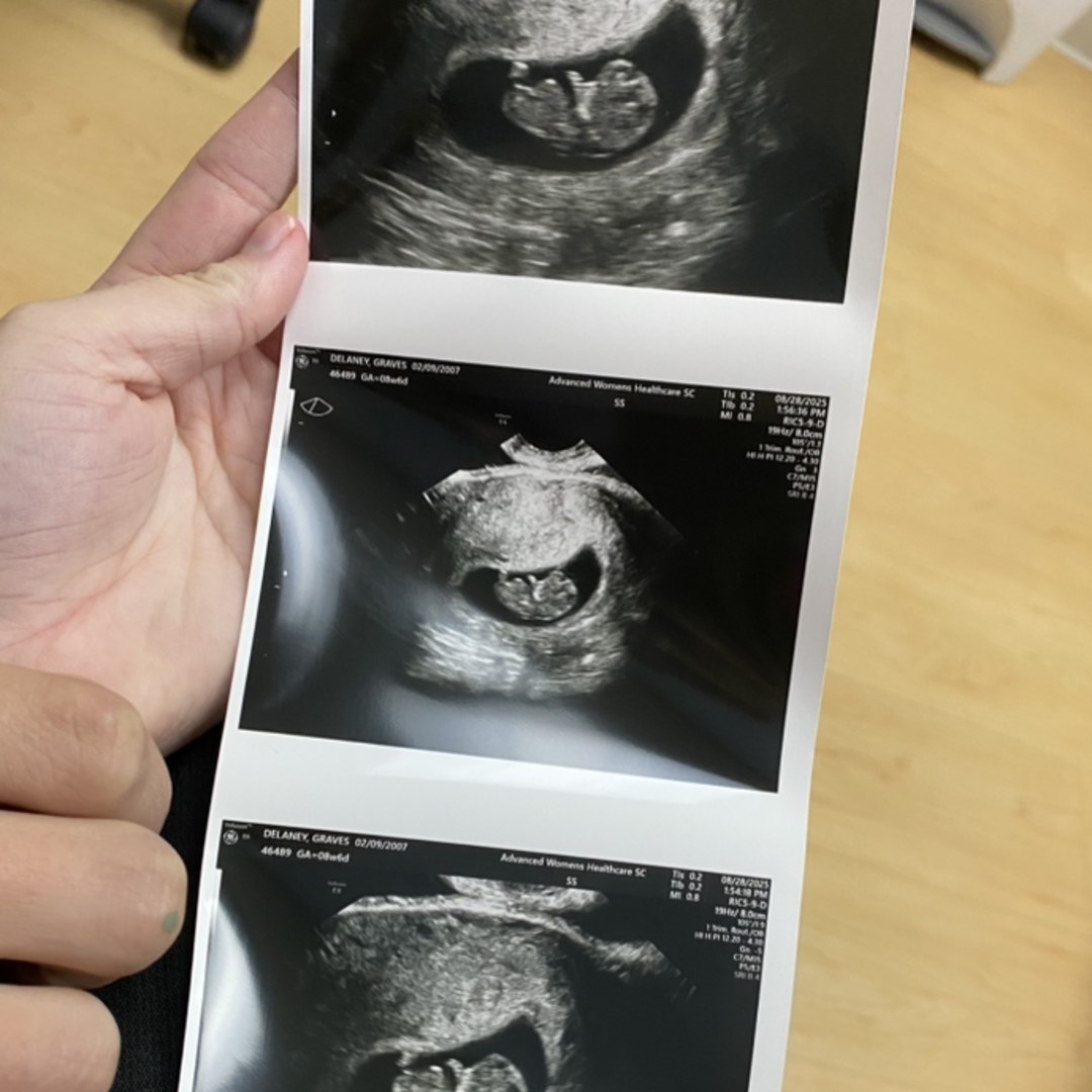 Photo shared by Delaney for their Babylist baby registry.