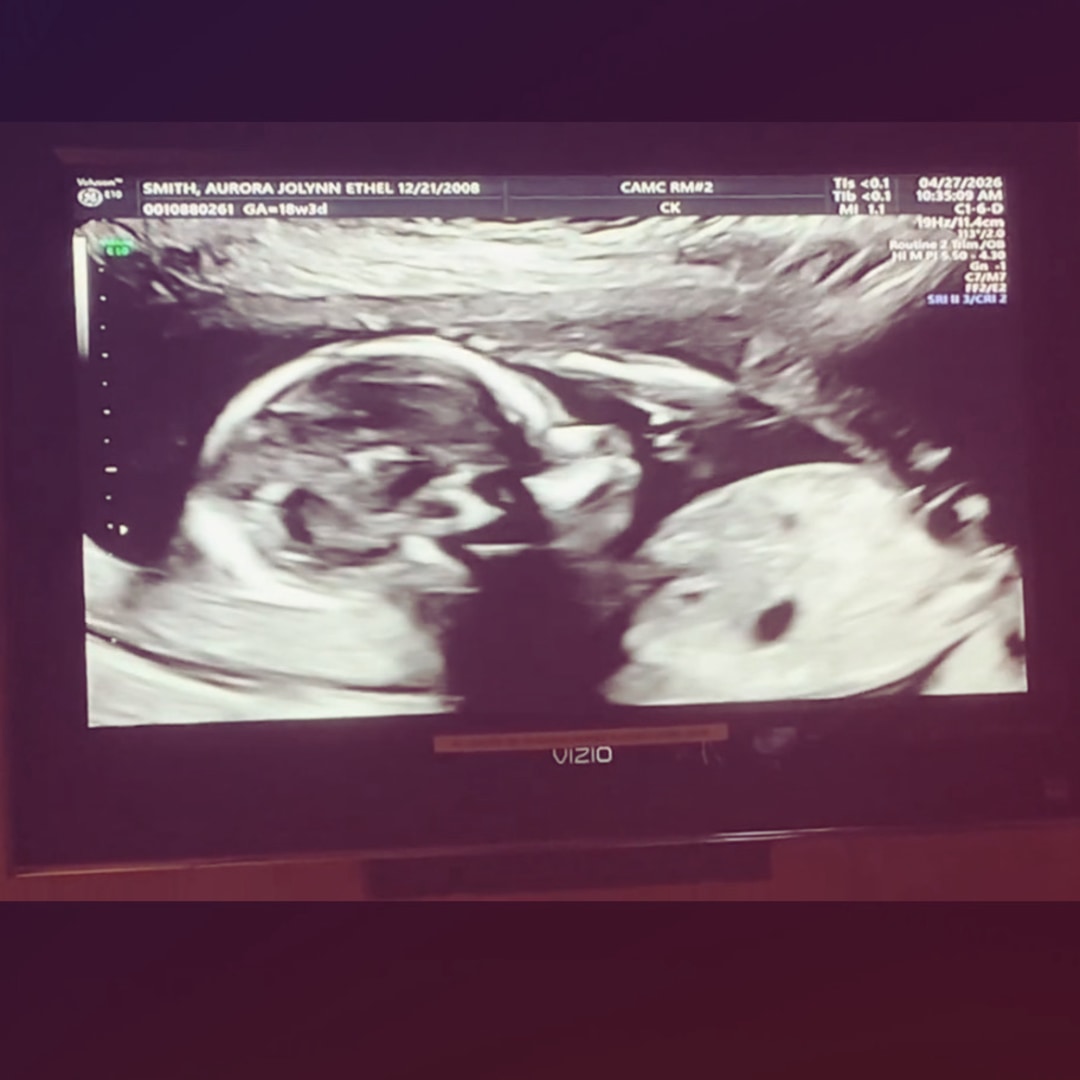 Photo shared by Aurora for their Babylist baby registry.