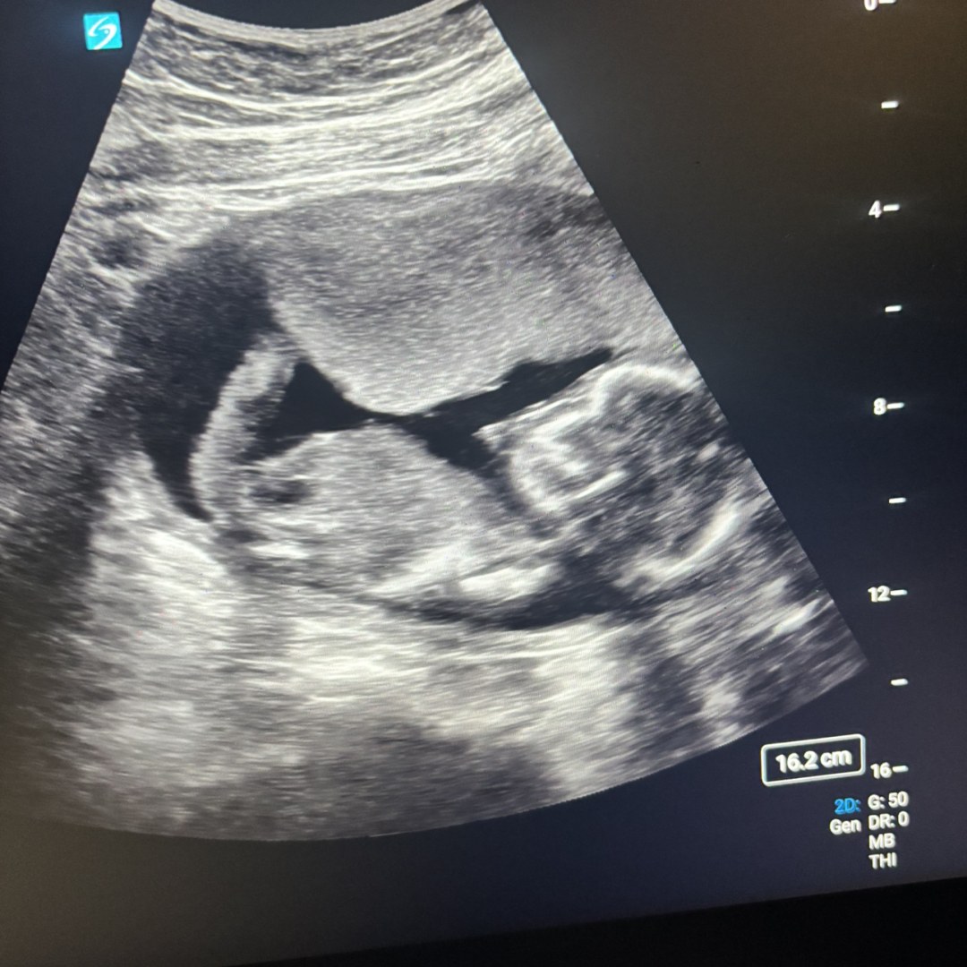 Photo shared by Marri for their Babylist baby registry.