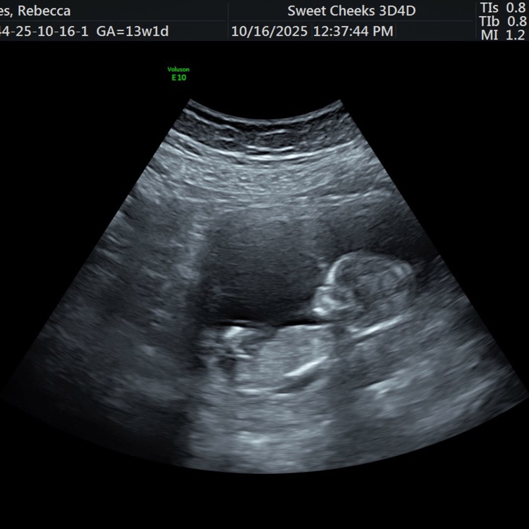 Photo shared by Rebecca for their Babylist baby registry.