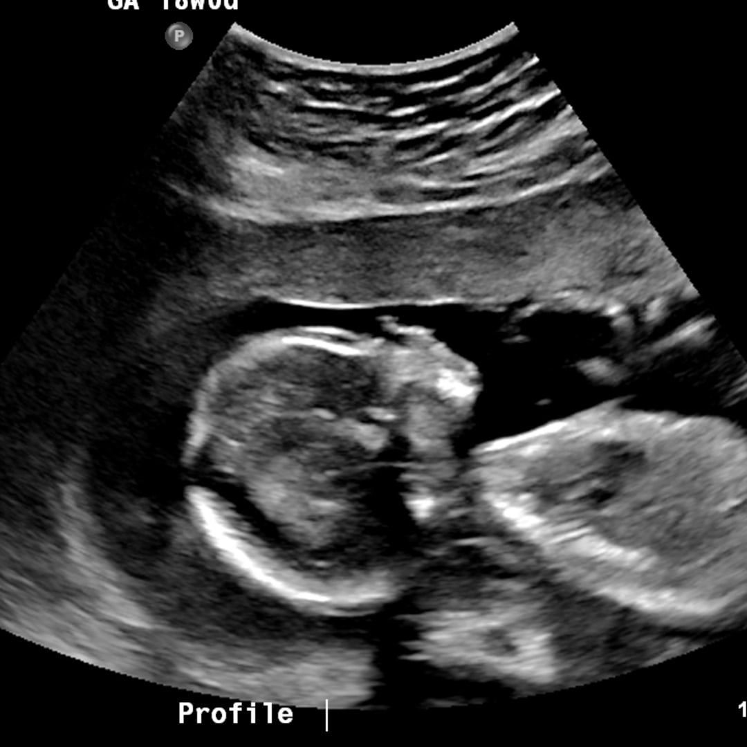 Photo shared by Natalie for their Babylist baby registry.