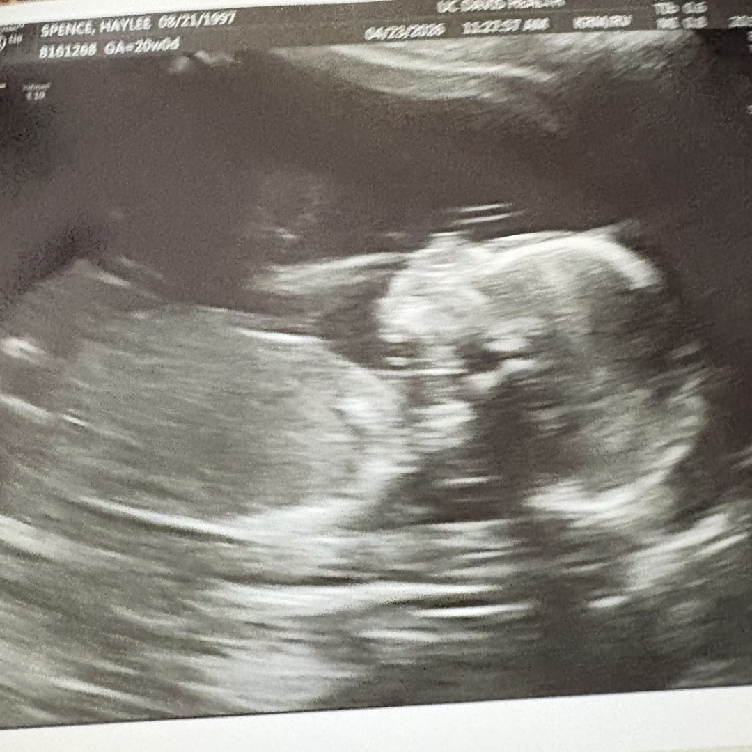 Photo shared by Haylee for their Babylist baby registry.