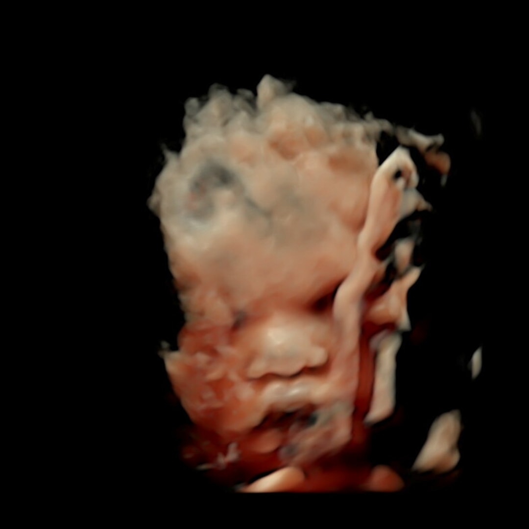 Photo shared by Angel for their Babylist baby registry.