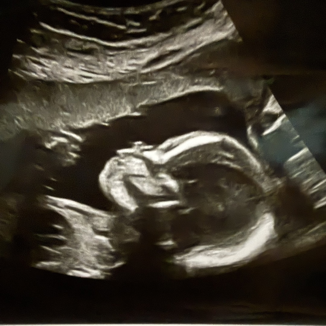 Photo shared by Joanne for their Babylist baby registry.