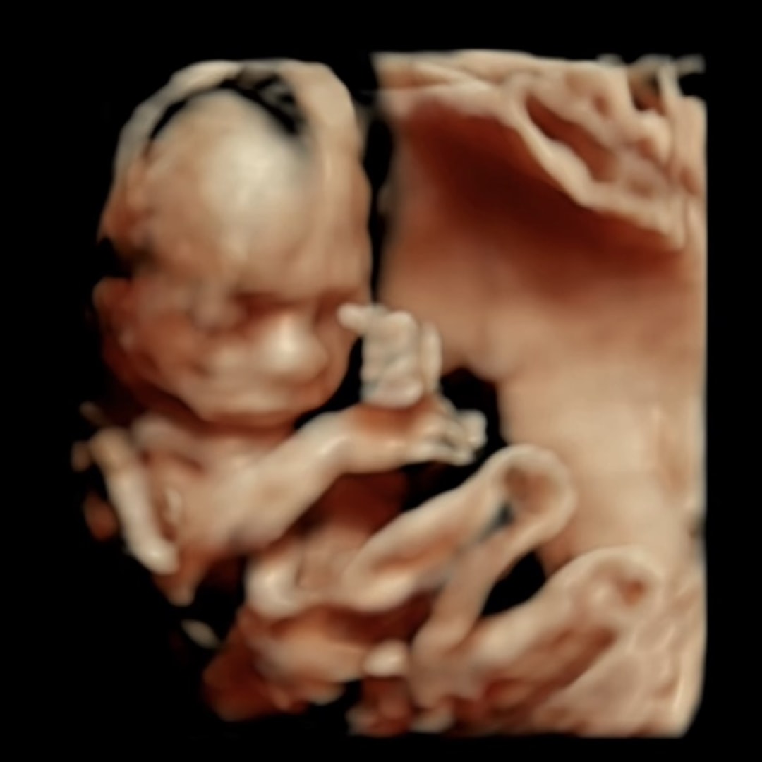 Photo shared by Cassandra for their Babylist baby registry.