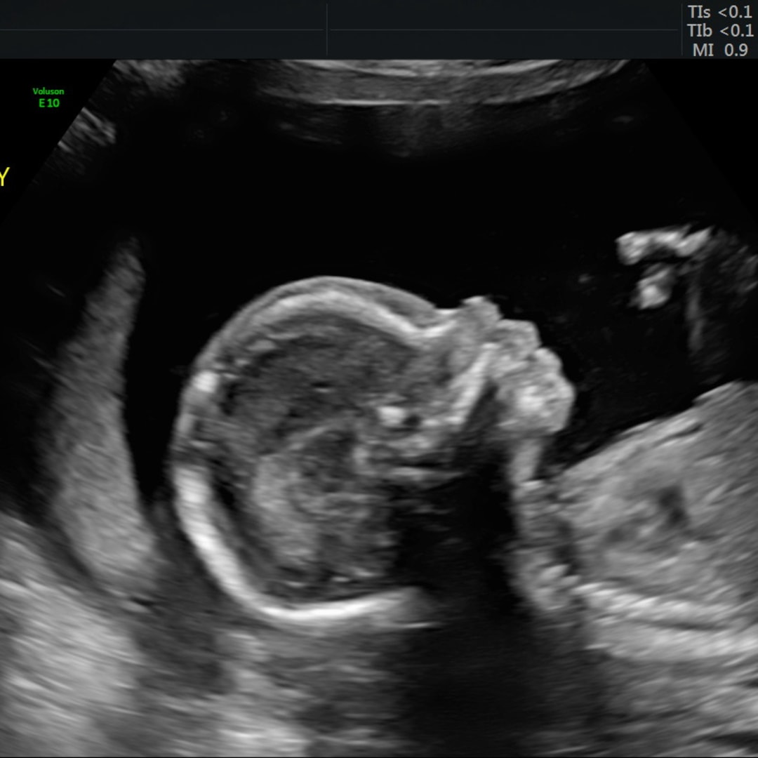 Photo shared by Becca for their Babylist baby registry.