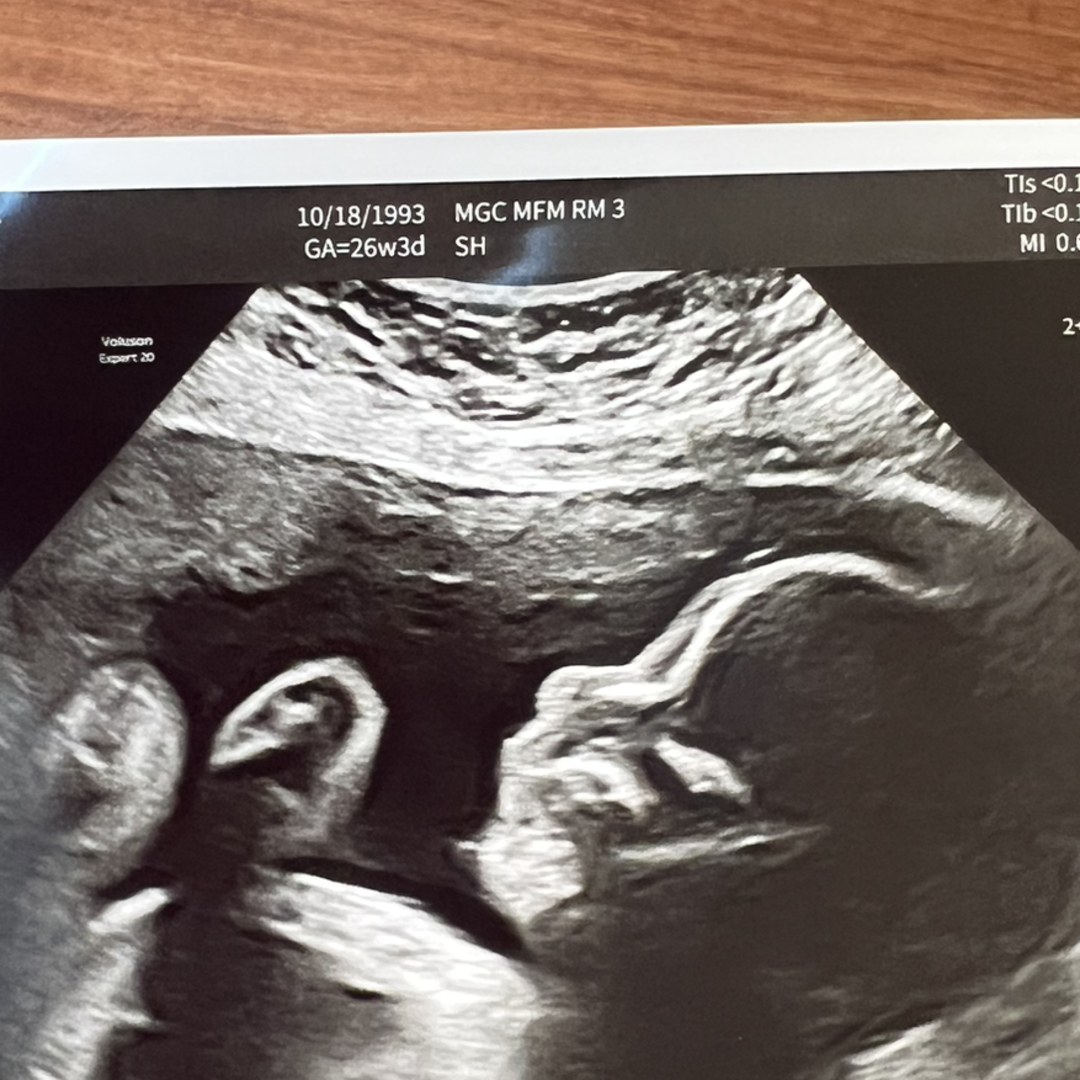 Photo shared by Haley for their Babylist baby registry.