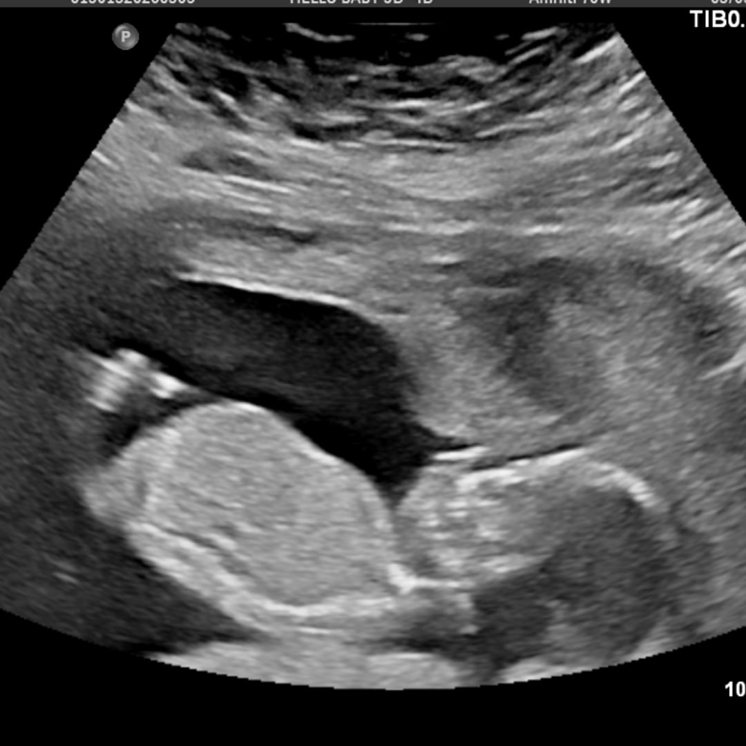 Photo shared by Alizé for their Babylist baby registry.