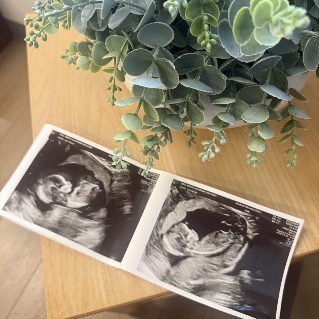 Photo shared by Gracie for their Babylist baby registry.