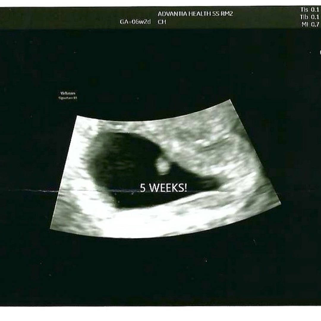 Photo shared by Haylee for their Babylist baby registry.