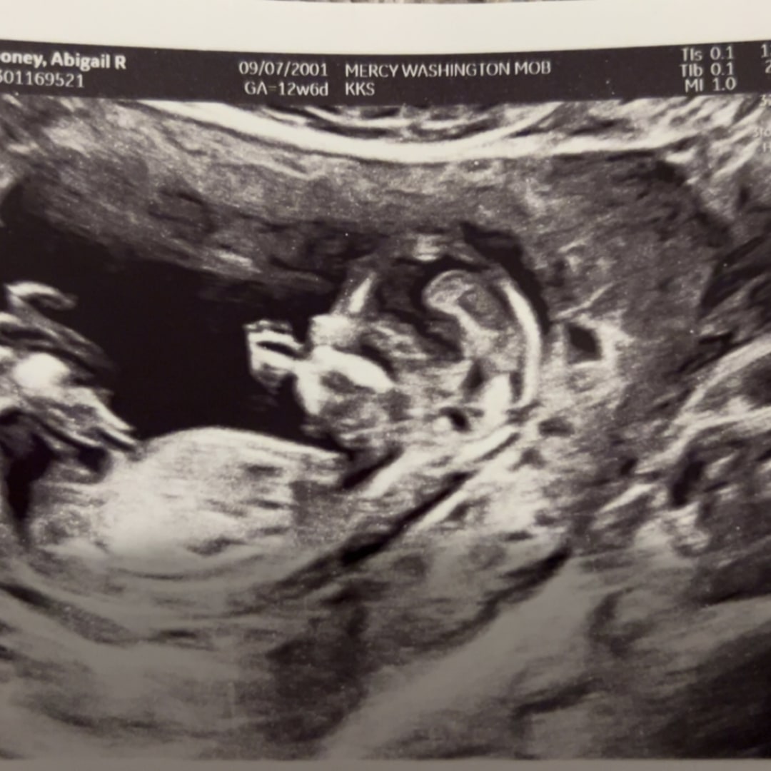 Photo shared by Abigail for their Babylist baby registry.