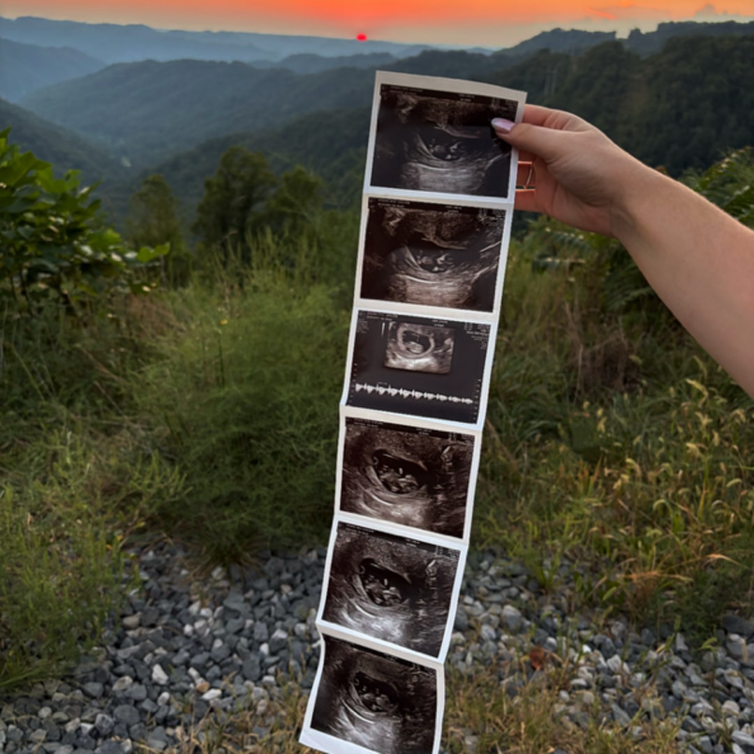 Photo shared by Emily for their Babylist baby registry.