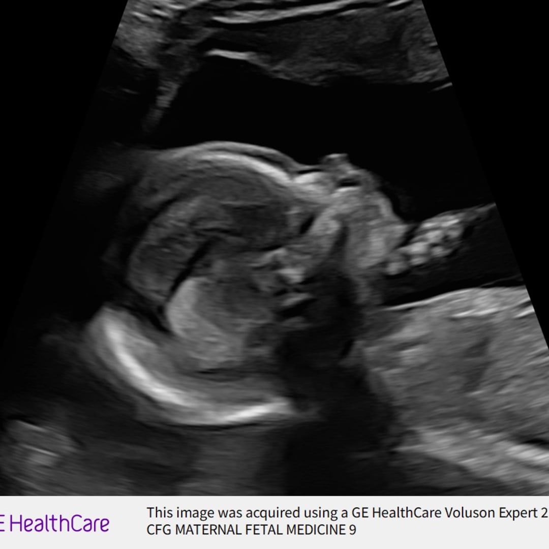 Photo shared by Emily for their Babylist baby registry.