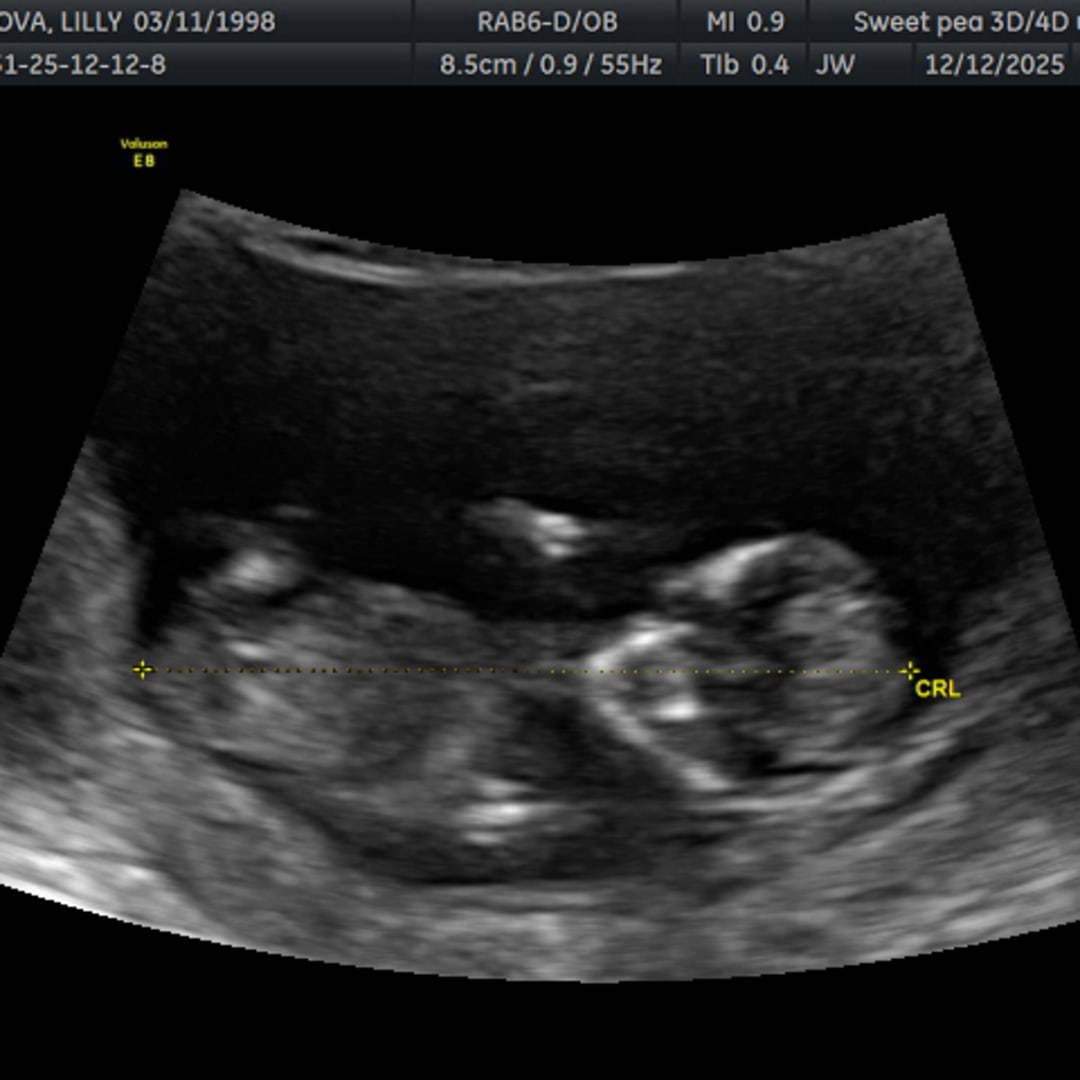 Photo shared by Lillian for their Babylist baby registry.