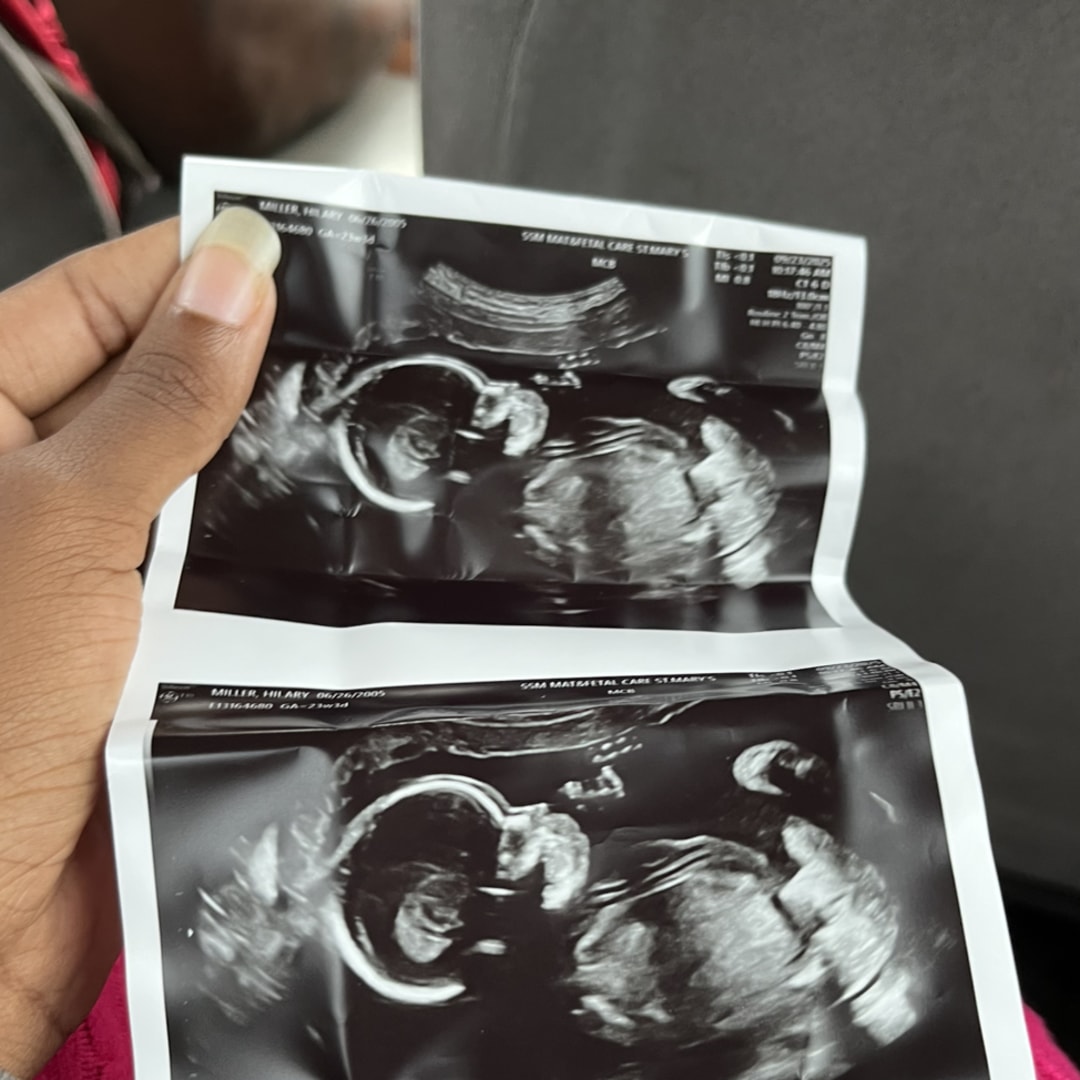 Photo shared by Hilary for their Babylist baby registry.