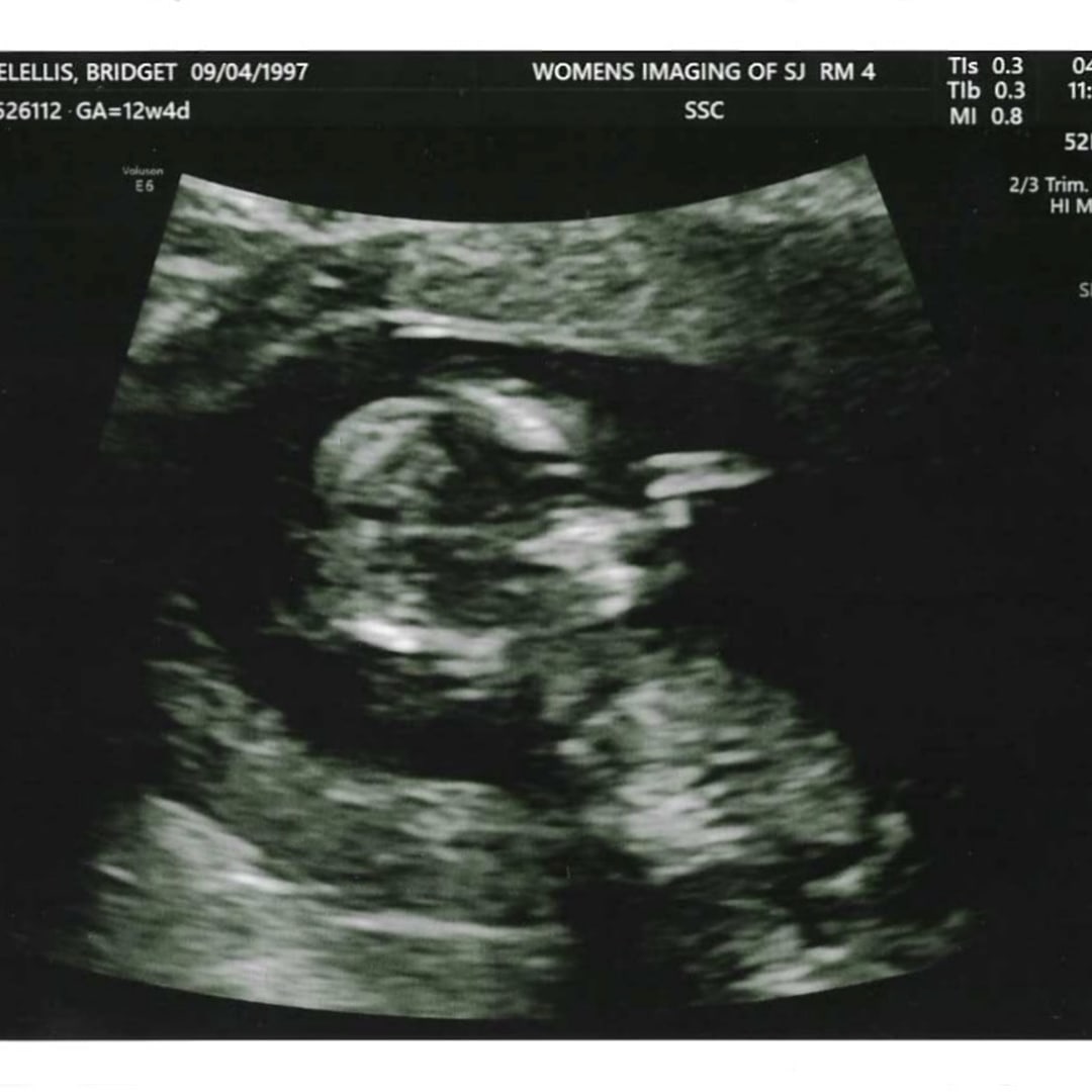 Photo shared by Bridget for their Babylist baby registry.