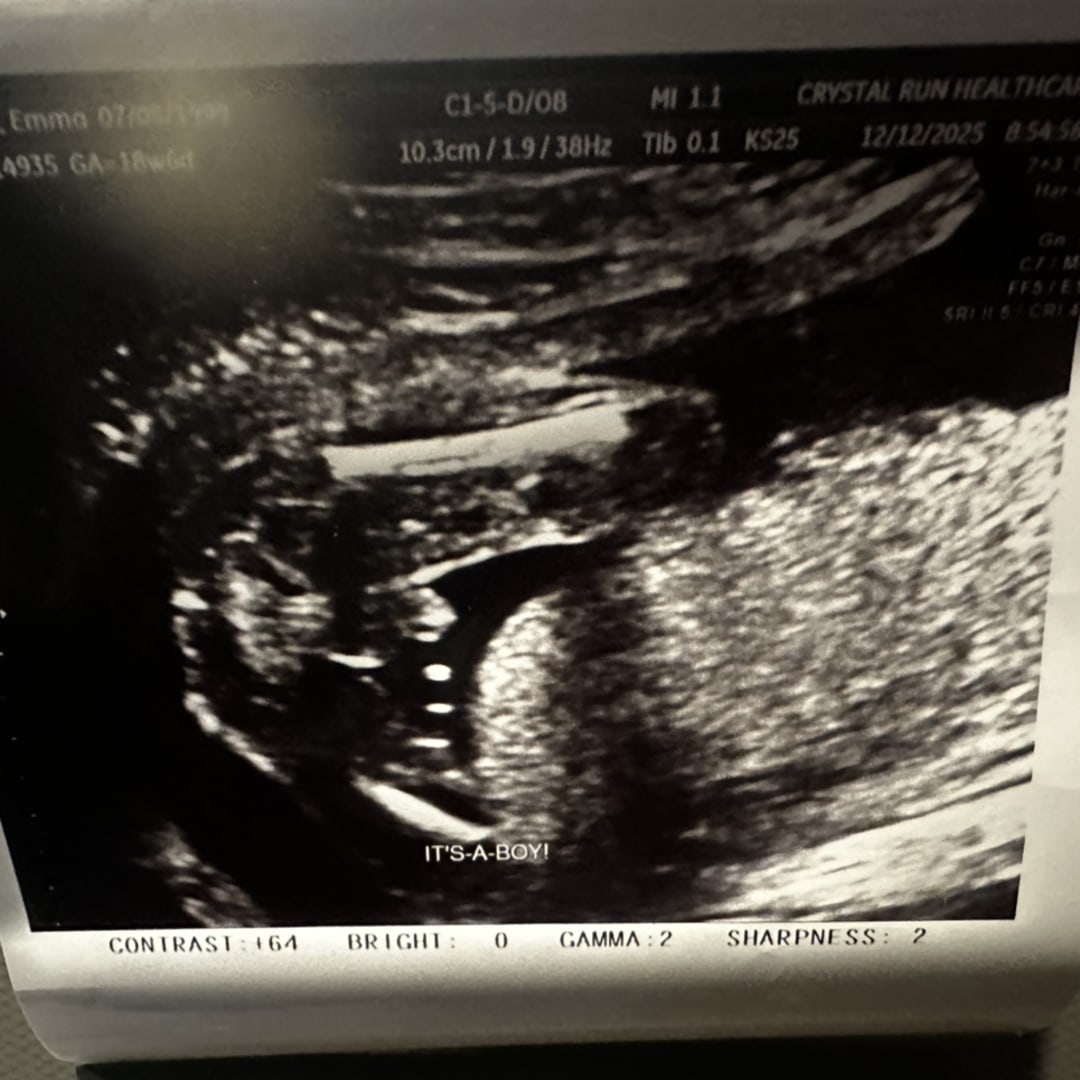 Photo shared by Emma for their Babylist baby registry.